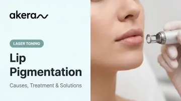 Lip Pigmentation: Causes, Treatment &amp; Solutions