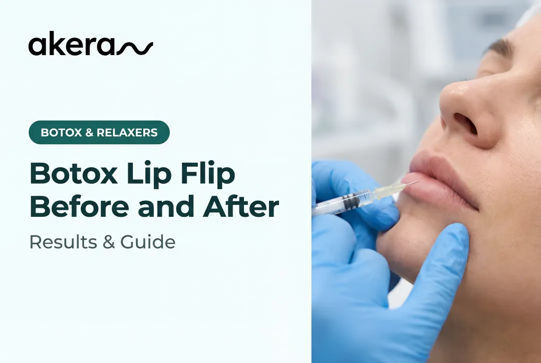 Botox Lip Flip Before and After: Results & Guide
