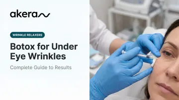 Botox for Under Eye Wrinkles: Complete Guide to Results
