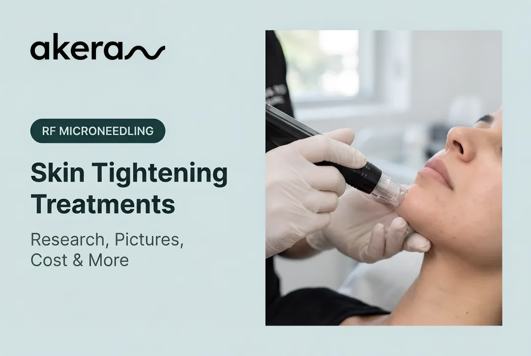 Skin Tightening Treatments: Research, Pictures, Cost & More