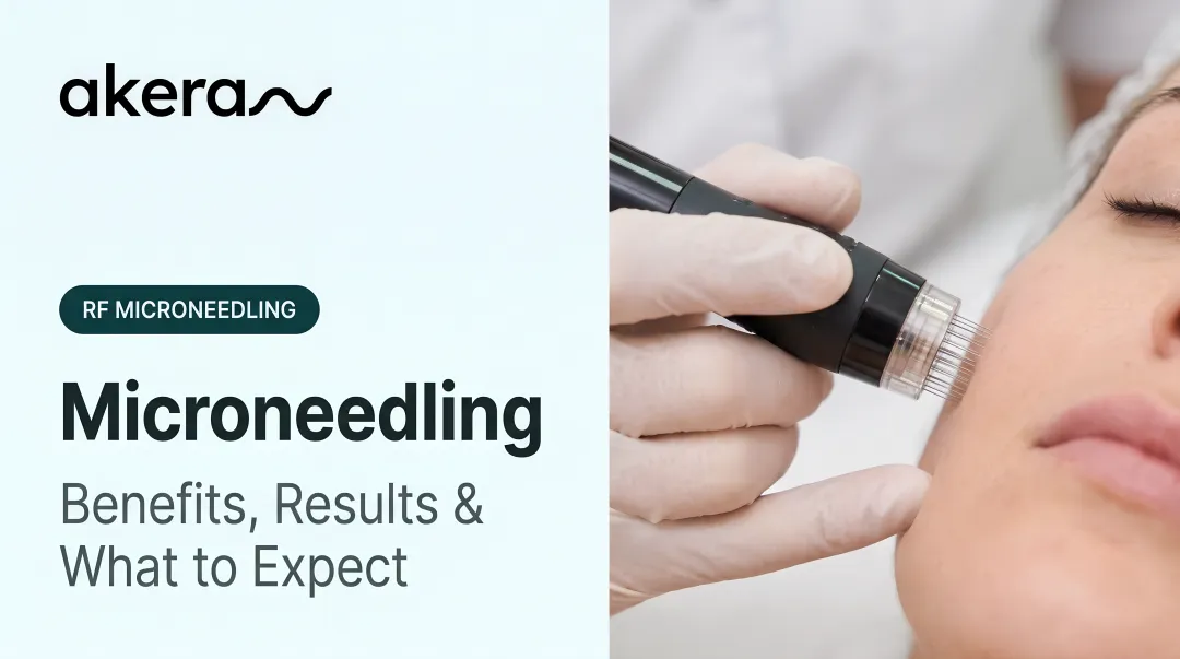 Microneedling: Benefits, Results &amp; What to Expect