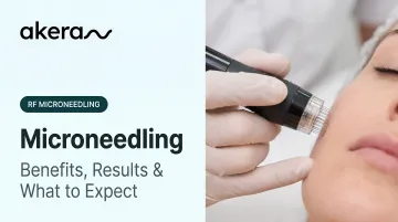 Microneedling: Benefits, Results &amp; What to Expect