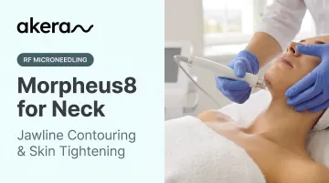 Morpheus8 for Neck: Jawline Contouring &amp; Skin Tightening