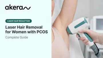 Laser Hair Removal for Women with PCOS: Complete Guide