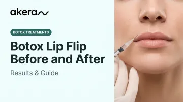 Botox Lip Flip Before and After: Results &amp; Guide