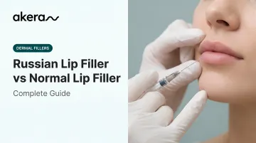 Russian Lip Filler vs Normal Lip Filler: Complete Guide