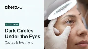 Dark Circles Under the Eyes: Causes &amp; Treatment
