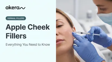 Apple Cheek Fillers: Everything You Need to Know