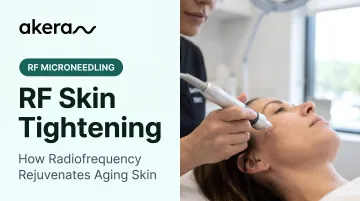 RF Skin Tightening: How Radiofrequency Rejuvenates Aging Skin