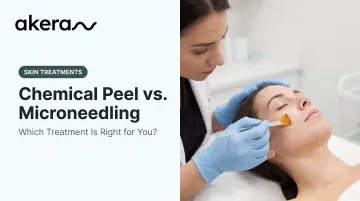Chemical Peel vs. Microneedling: Which Treatment Is Right for You?
