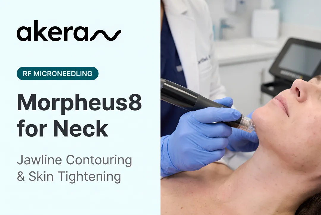 Morpheus8 for Neck: Jawline Contouring & Skin Tightening