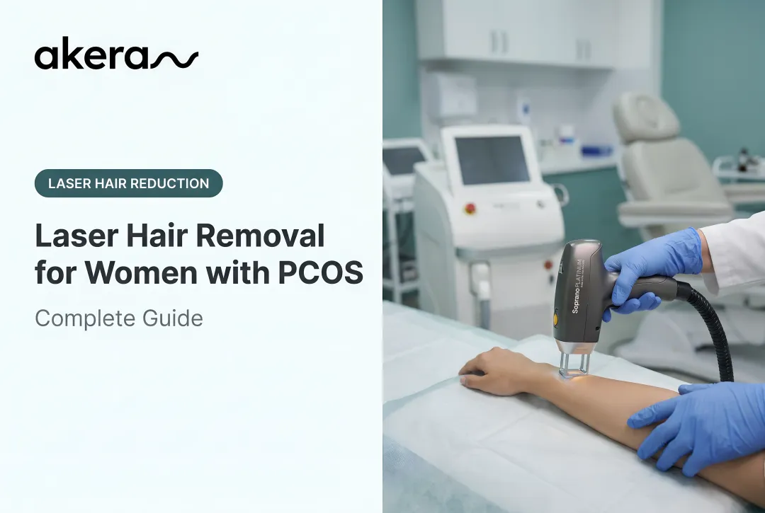 Laser Hair Removal for Women with PCOS: Complete Guide