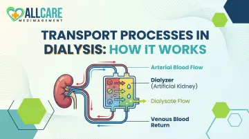 Transport Processes in Dialysis: How It Works