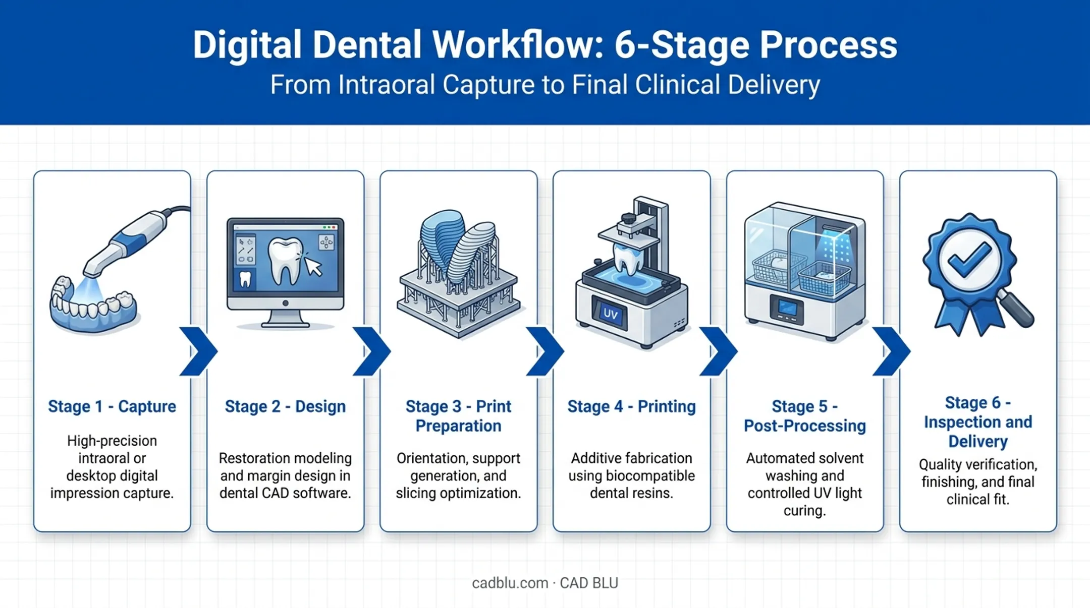 Six-stage digital dental workflow from scan to delivery diagram
