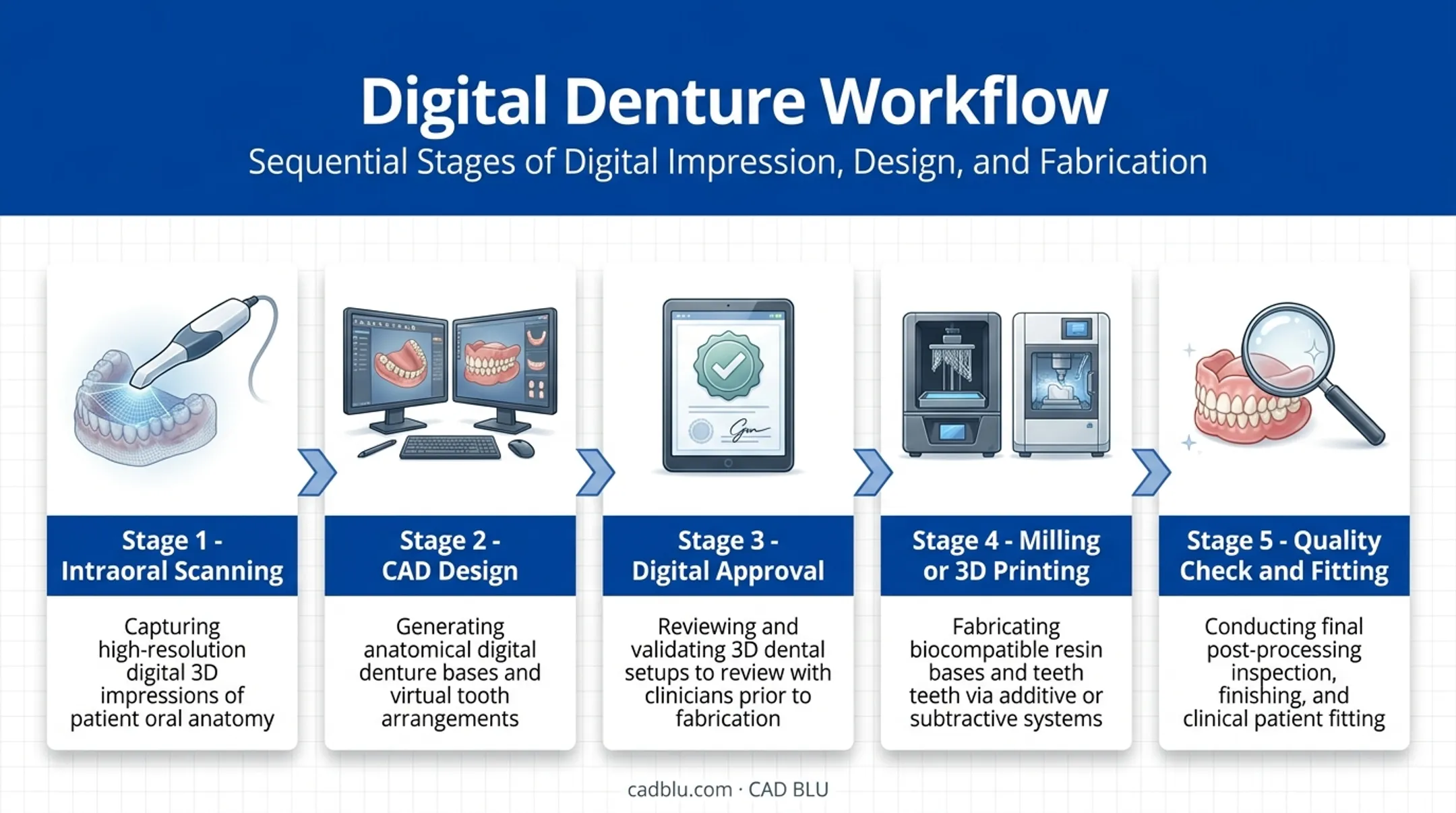 5-step digital denture workflow from intraoral scan to final fitting