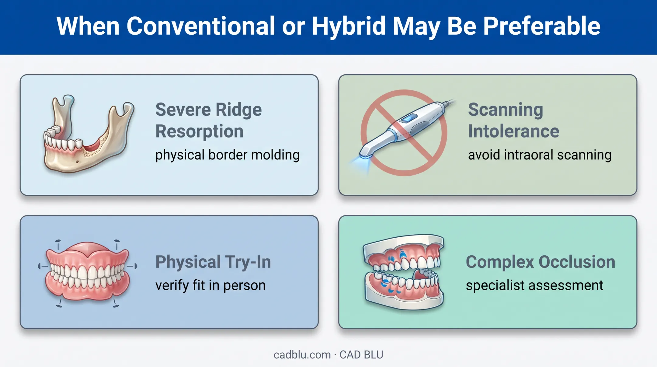 Four situations where conventional or hybrid denture workflows may be preferable