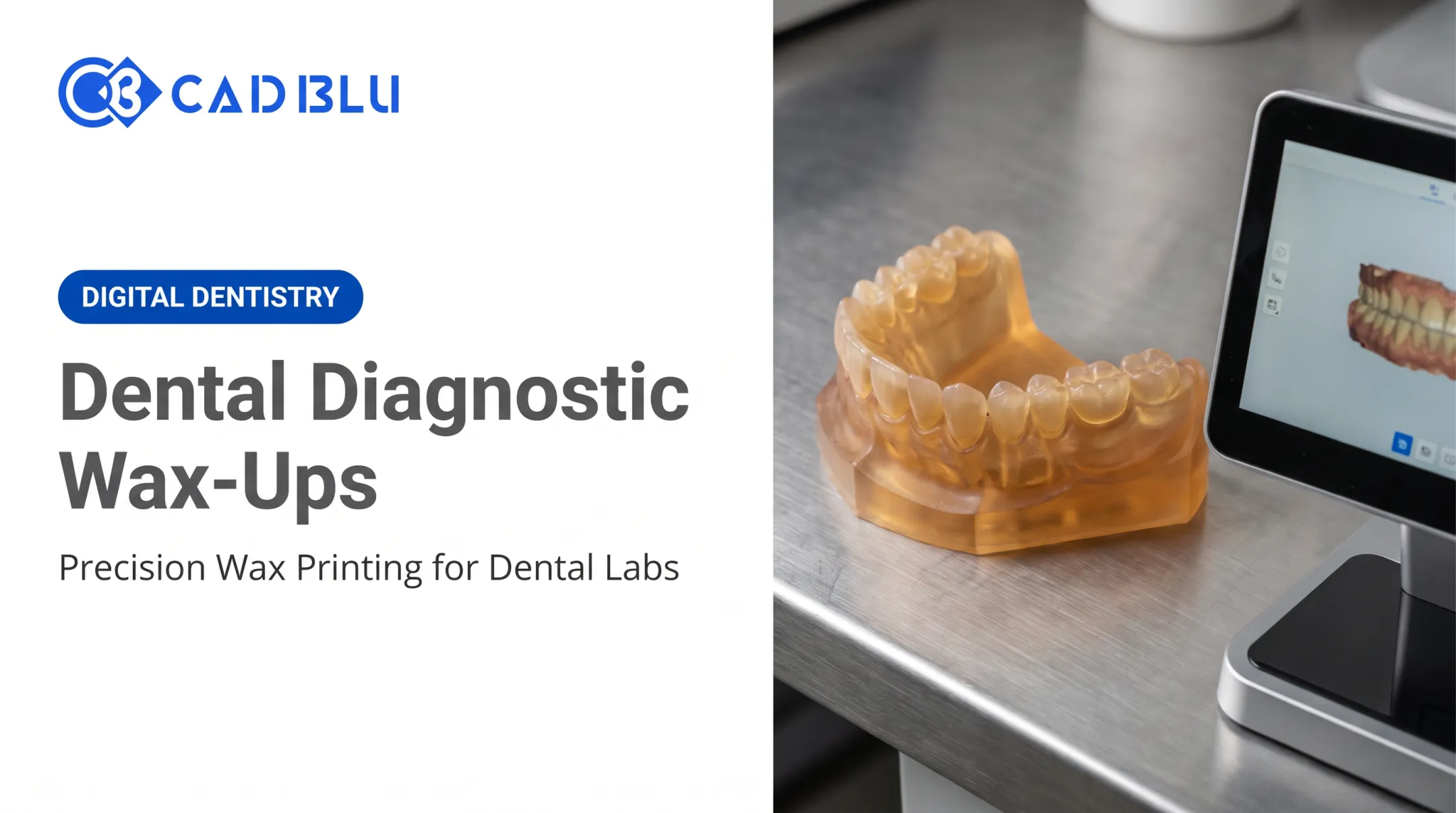 Dental Diagnostic Wax-Ups