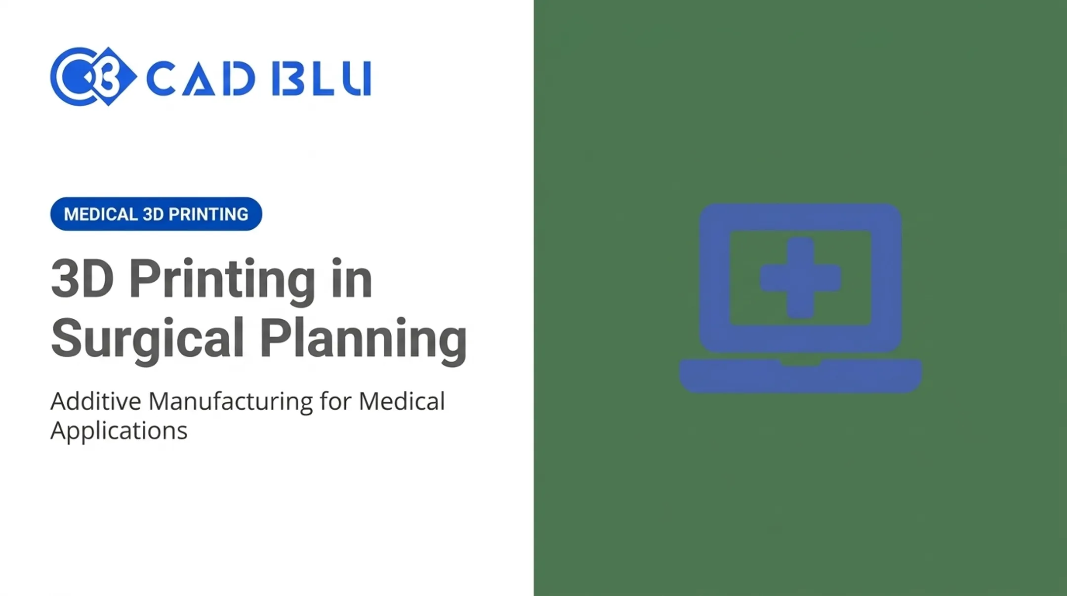 3D Printing in Surgical Planning