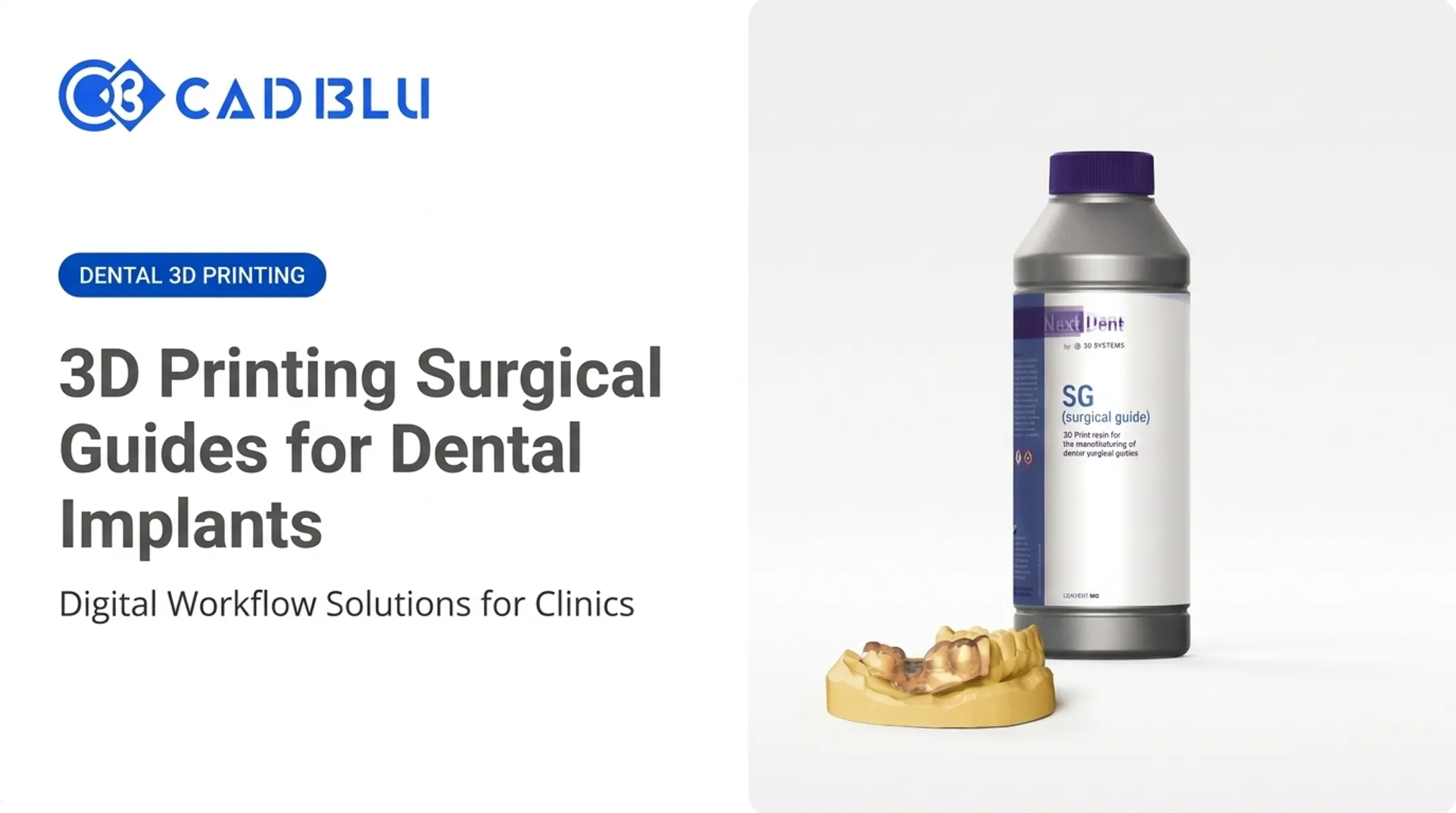 3D Printing Surgical Guides for Dental Implants