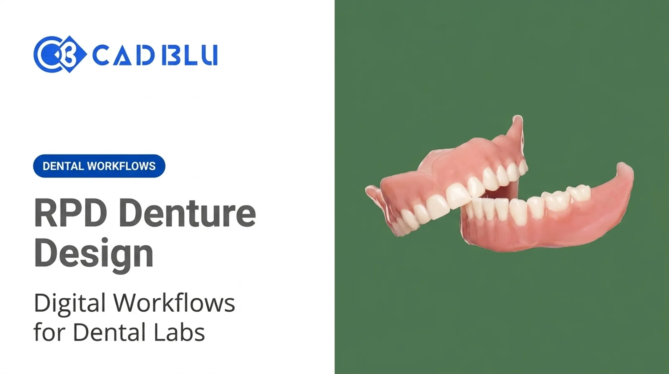 RPD Denture Design
