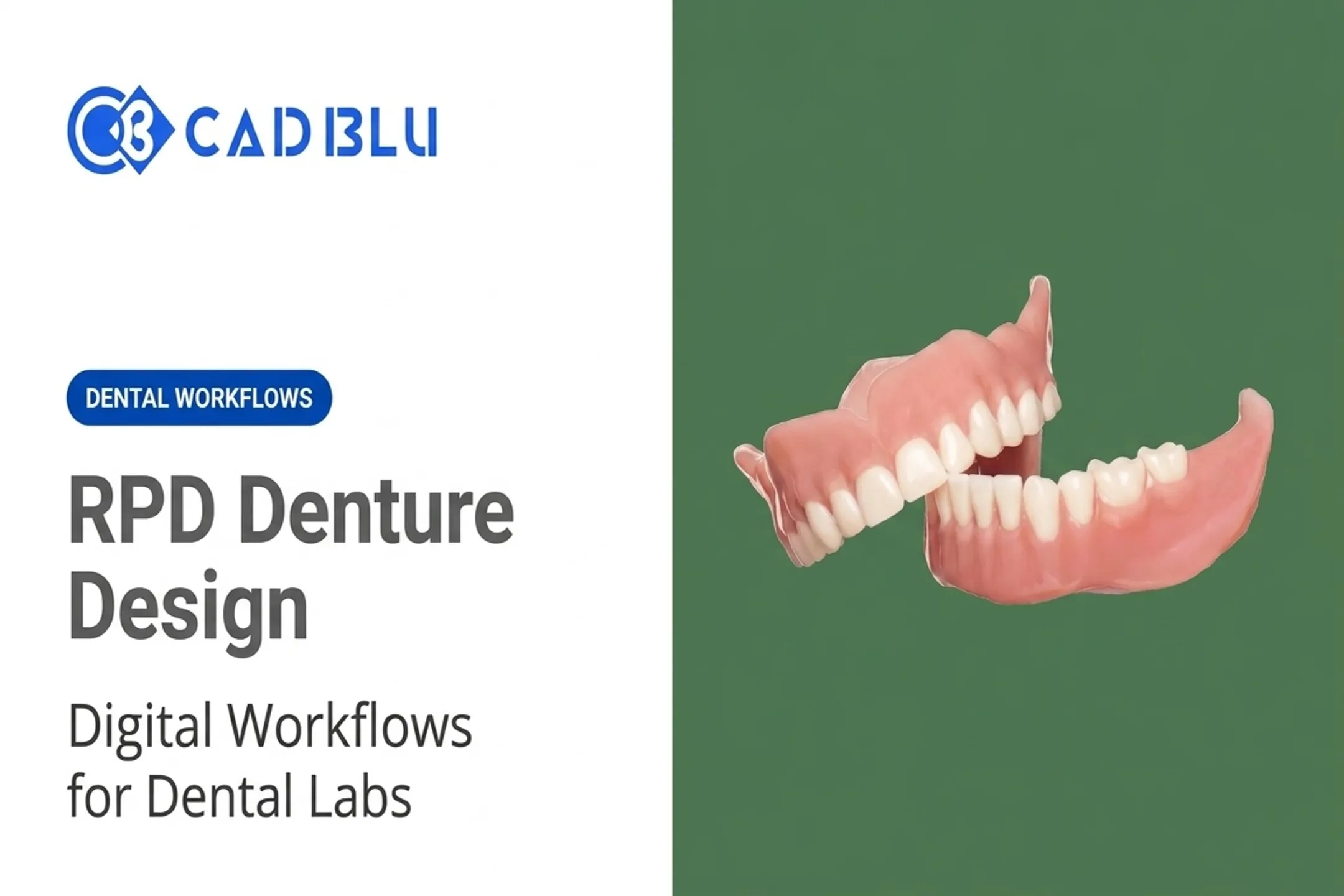 RPD Denture Design