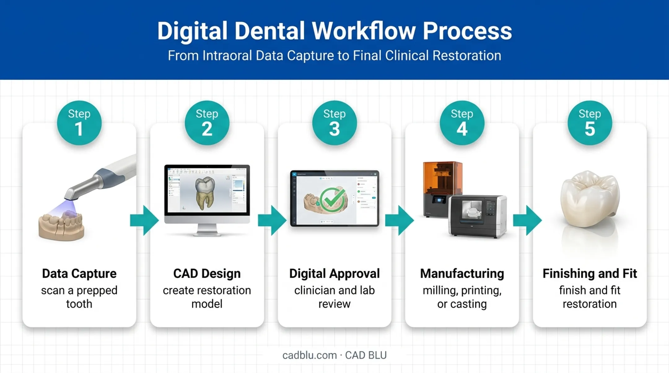 Digital dental workflow from scan capture to finished restoration