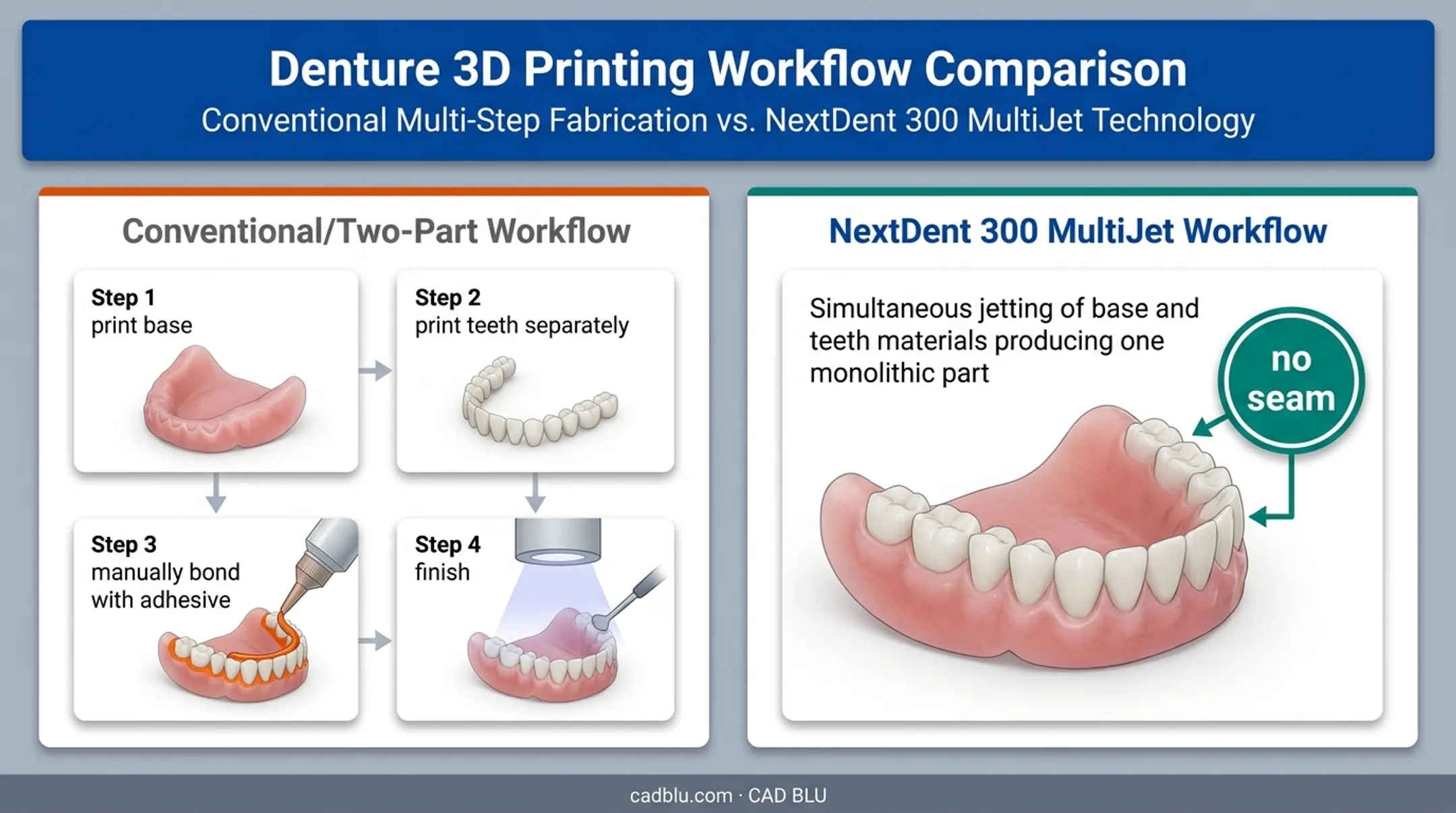 Conventional bonded denture assembly versus NextDent 300 monolithic printing comparison