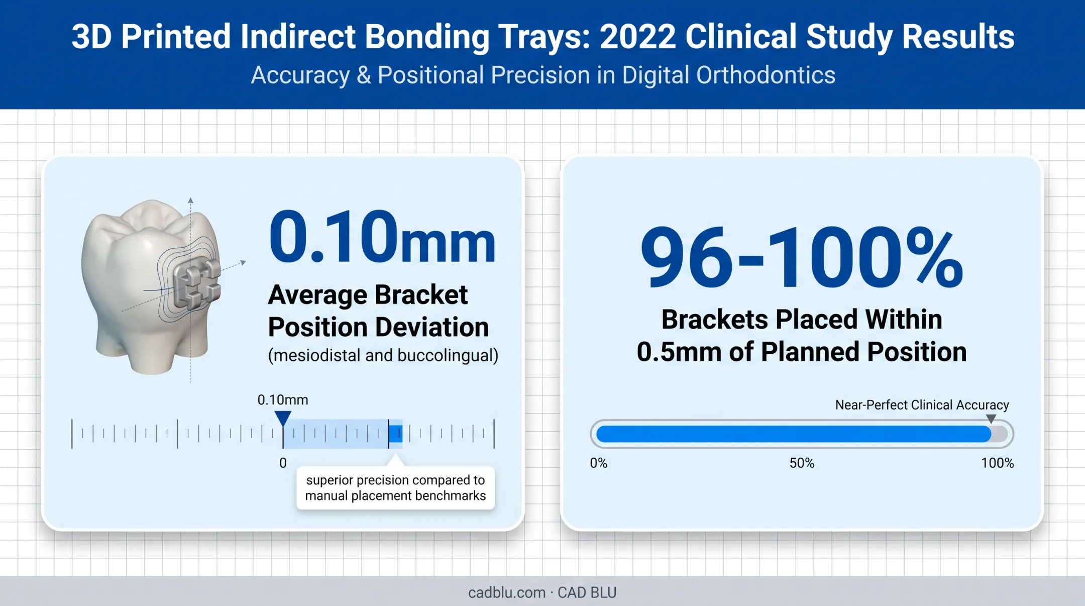 Indirect bonding tray bracket placement precision study results comparison