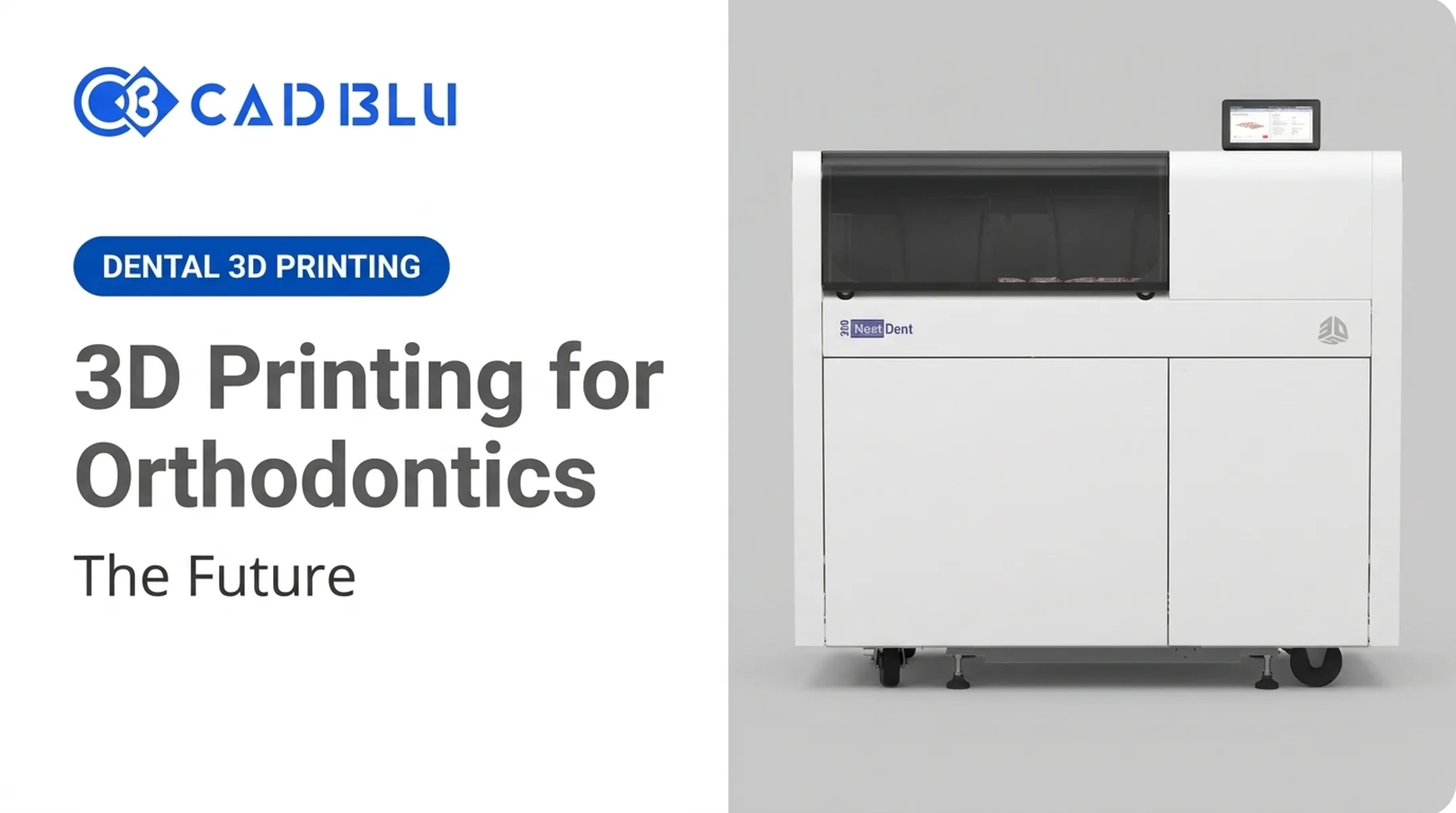 3D Printing for Orthodontics: The Future
