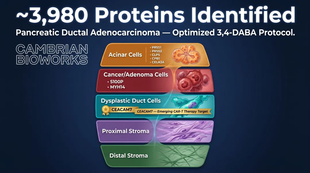 PDAC spatial proteomics cell population protein markers identified via 3,4-DABA decrosslinking protocol