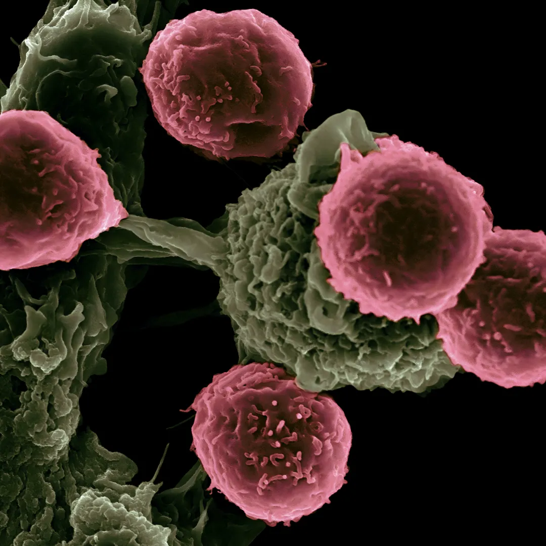 Oncology Research