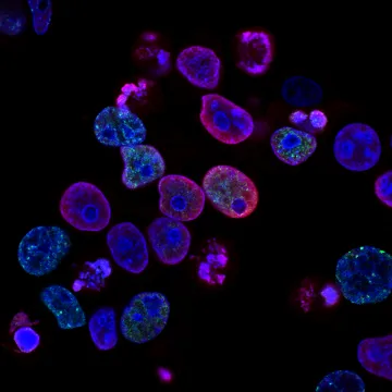 Reproductive & Genetic Testing