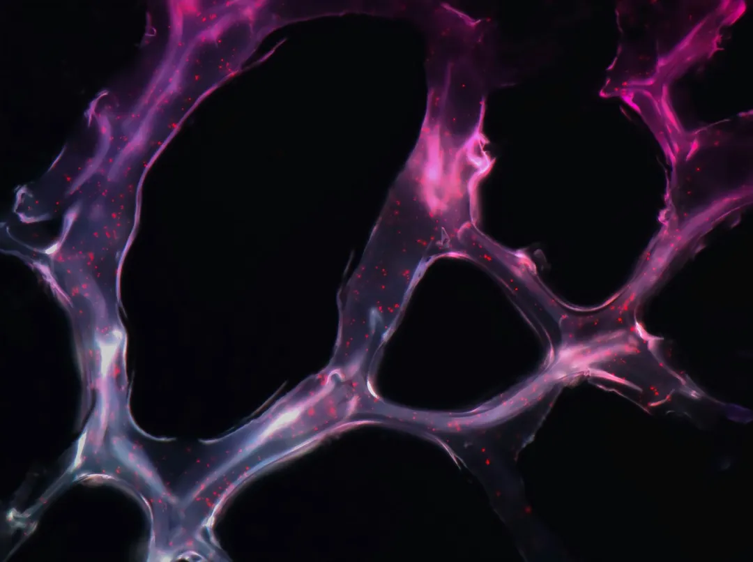 Translational Research