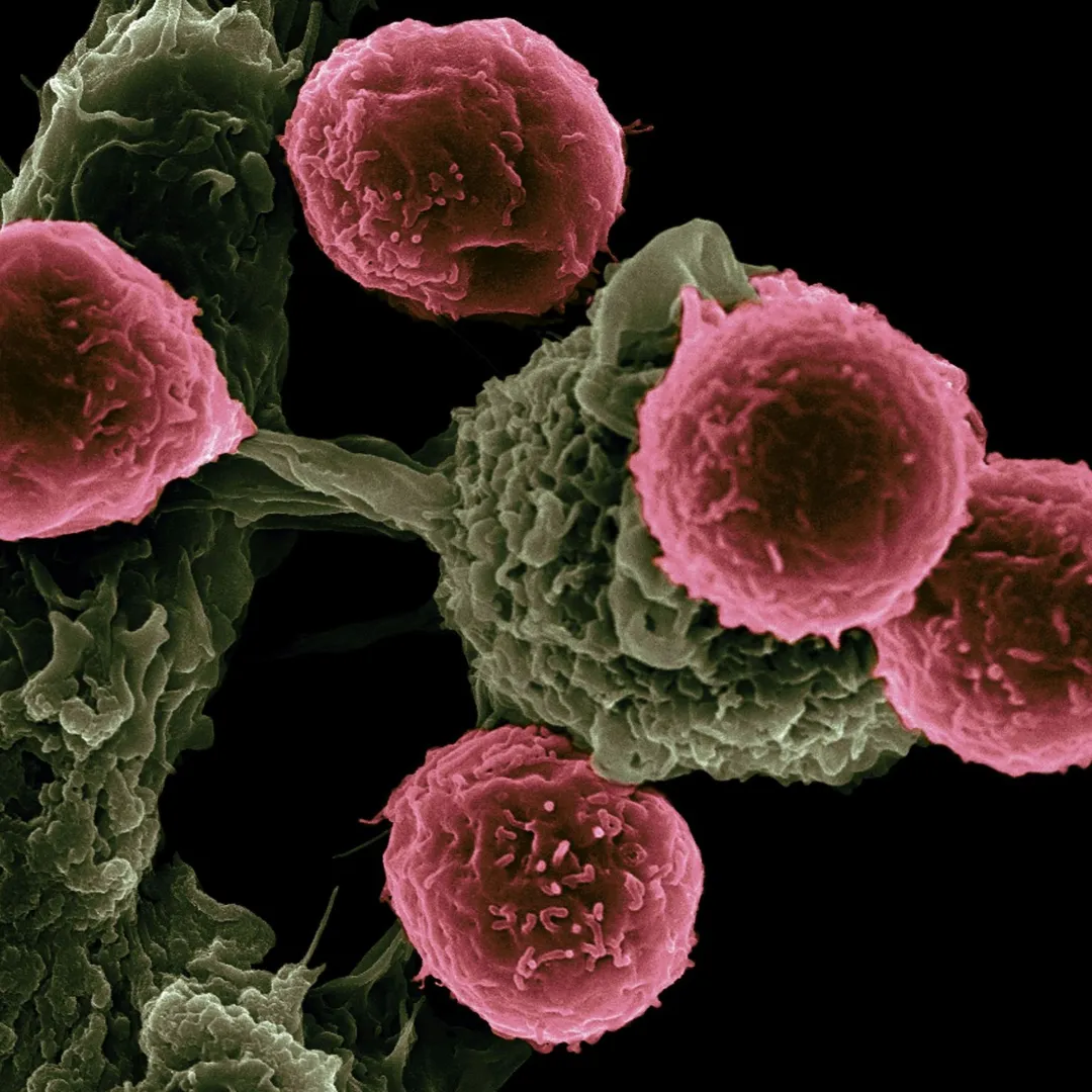 Oncology