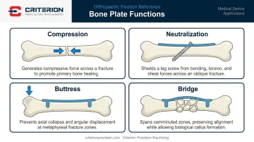 Four bone plate mechanical functions compression neutralization buttress and bridge fixation diagram