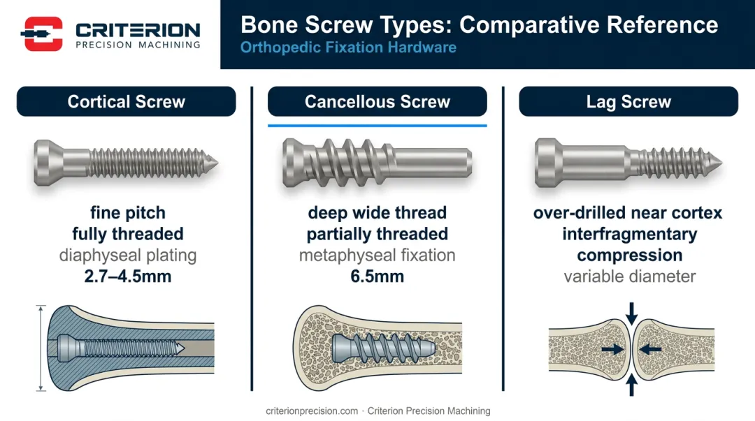Cortical cancellous and lag bone screw comparison table with thread geometry and applications
