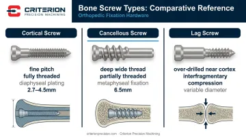 Cortical cancellous and lag bone screw comparison table with thread geometry and applications