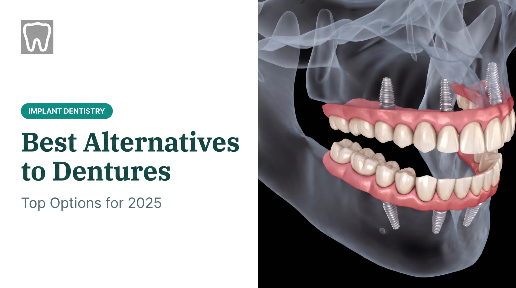 Best Alternatives to Dentures: Top Options for 2025