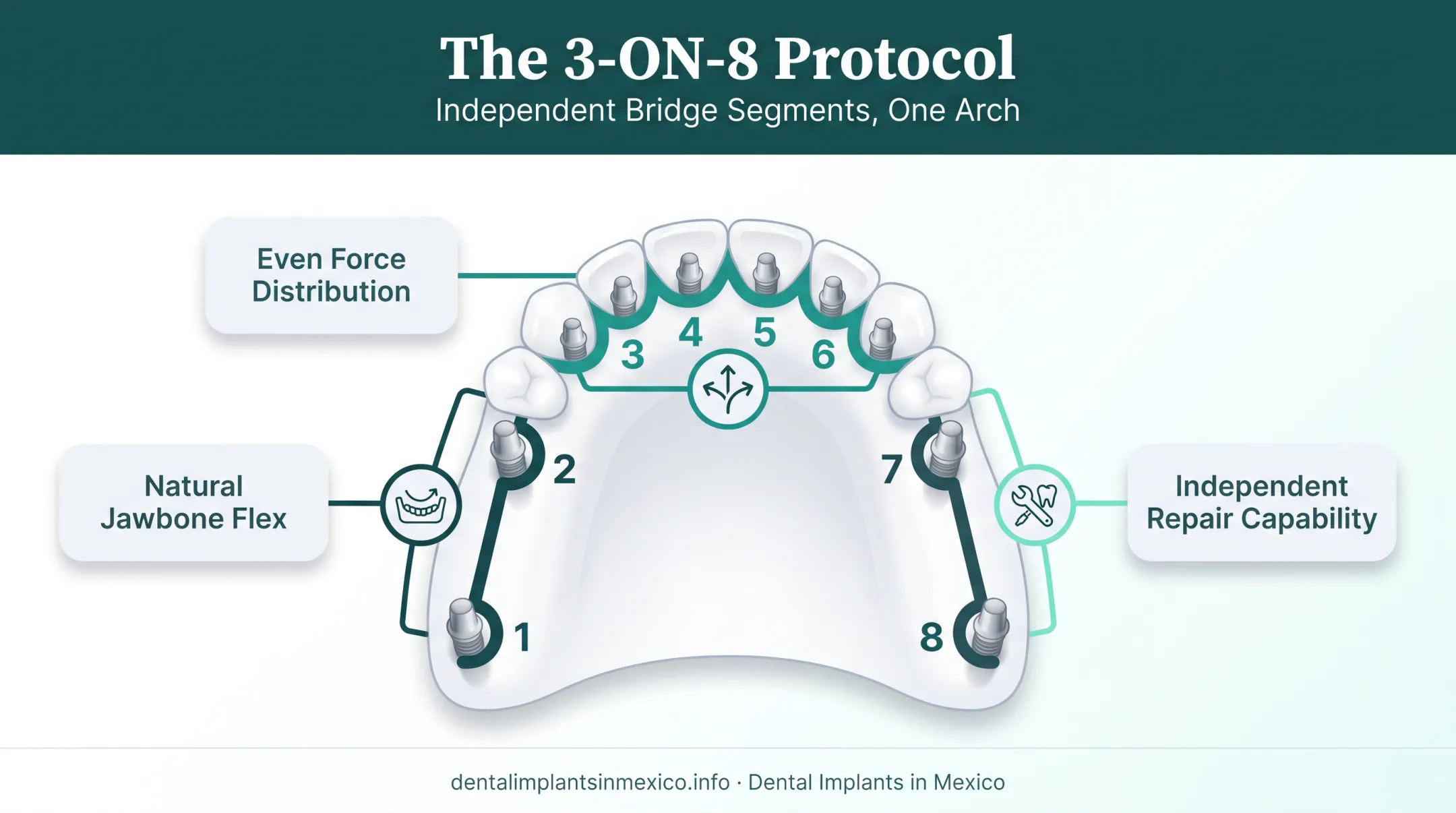 3-ON-8 protocol three independent zirconia bridges segmented design diagram