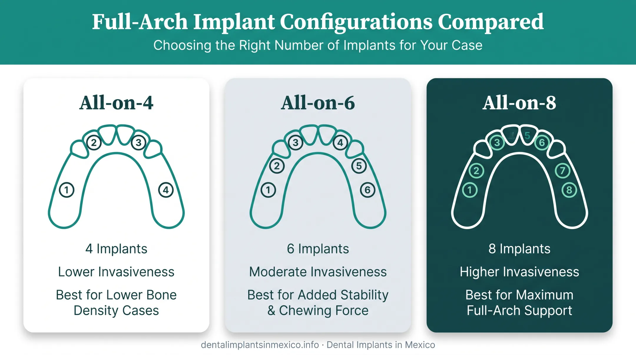 All-on-4 versus All-on-6 versus All-on-8 implant comparison diagram