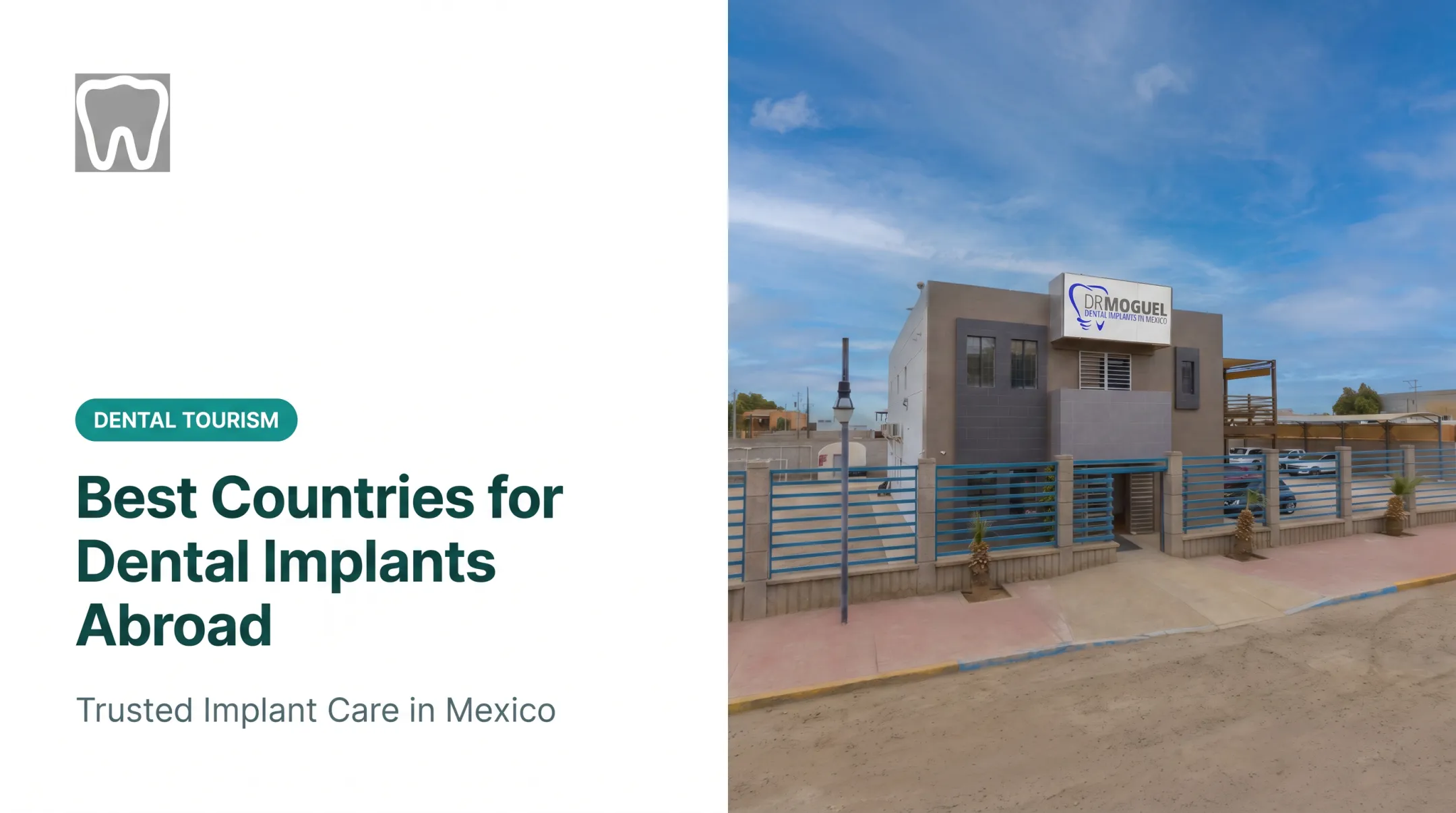 Best Countries for Dental Implants Abroad
