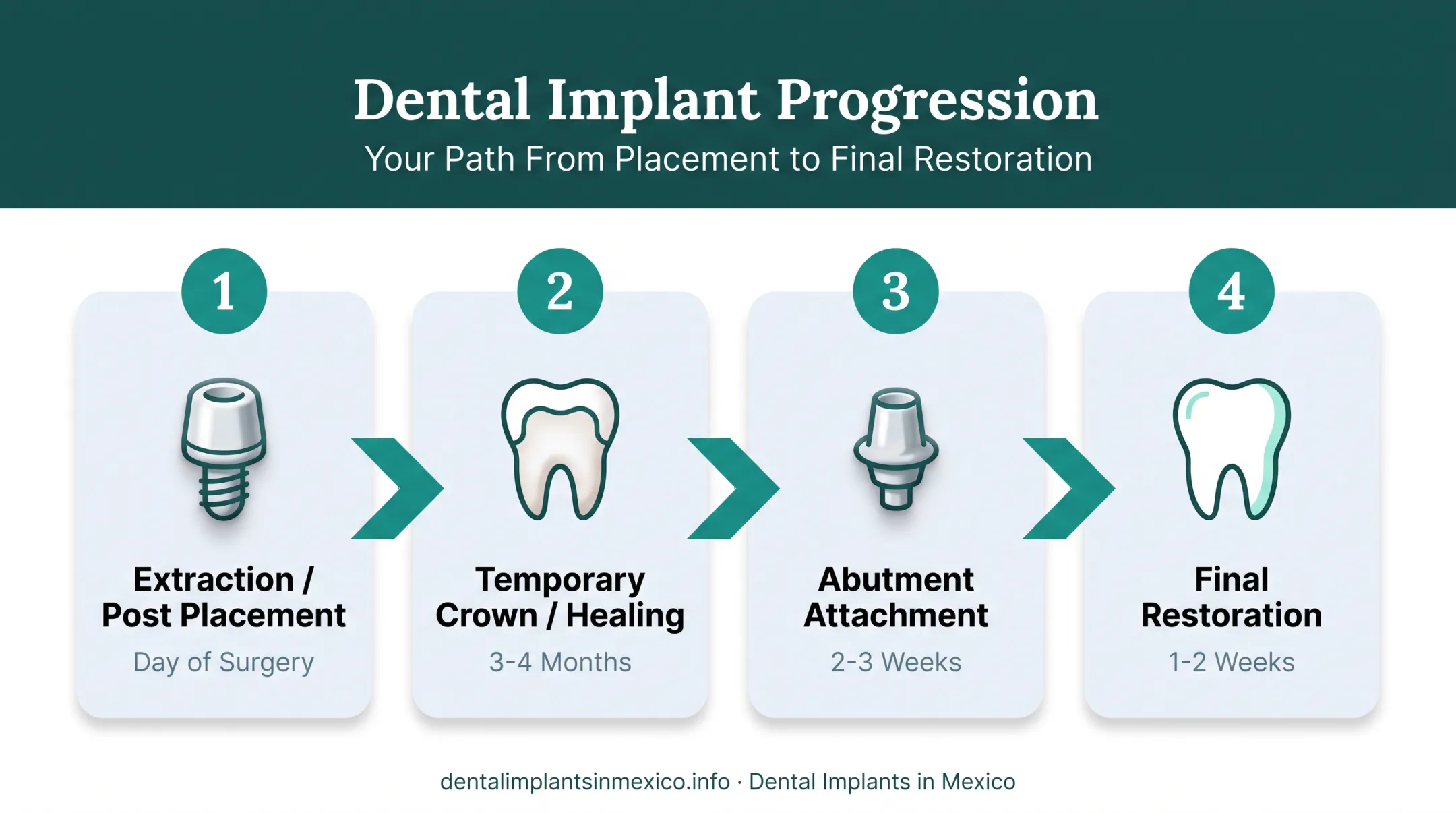 Four stages of dental implant healing from placement to final crown