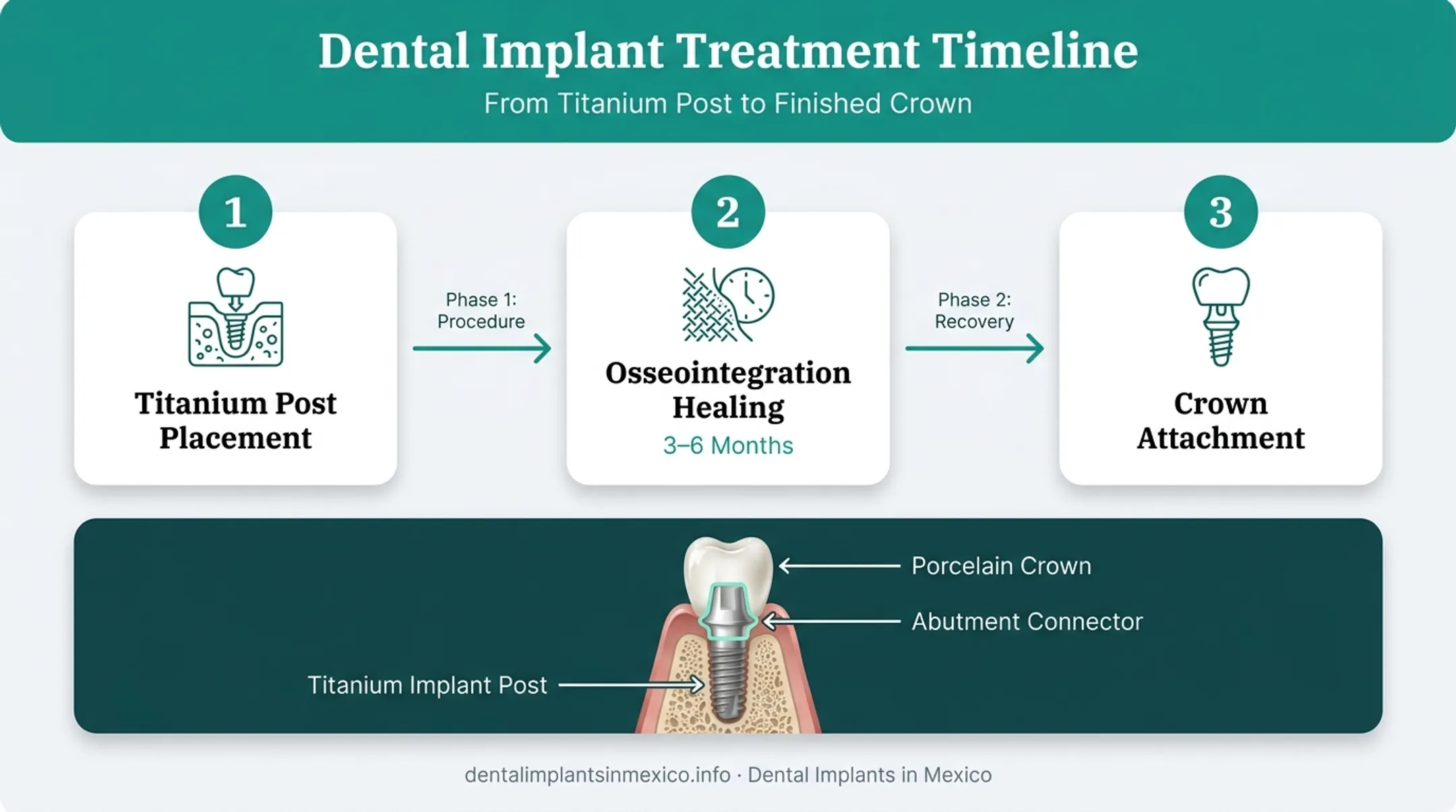 Dental implant osseointegration process from placement to full healing