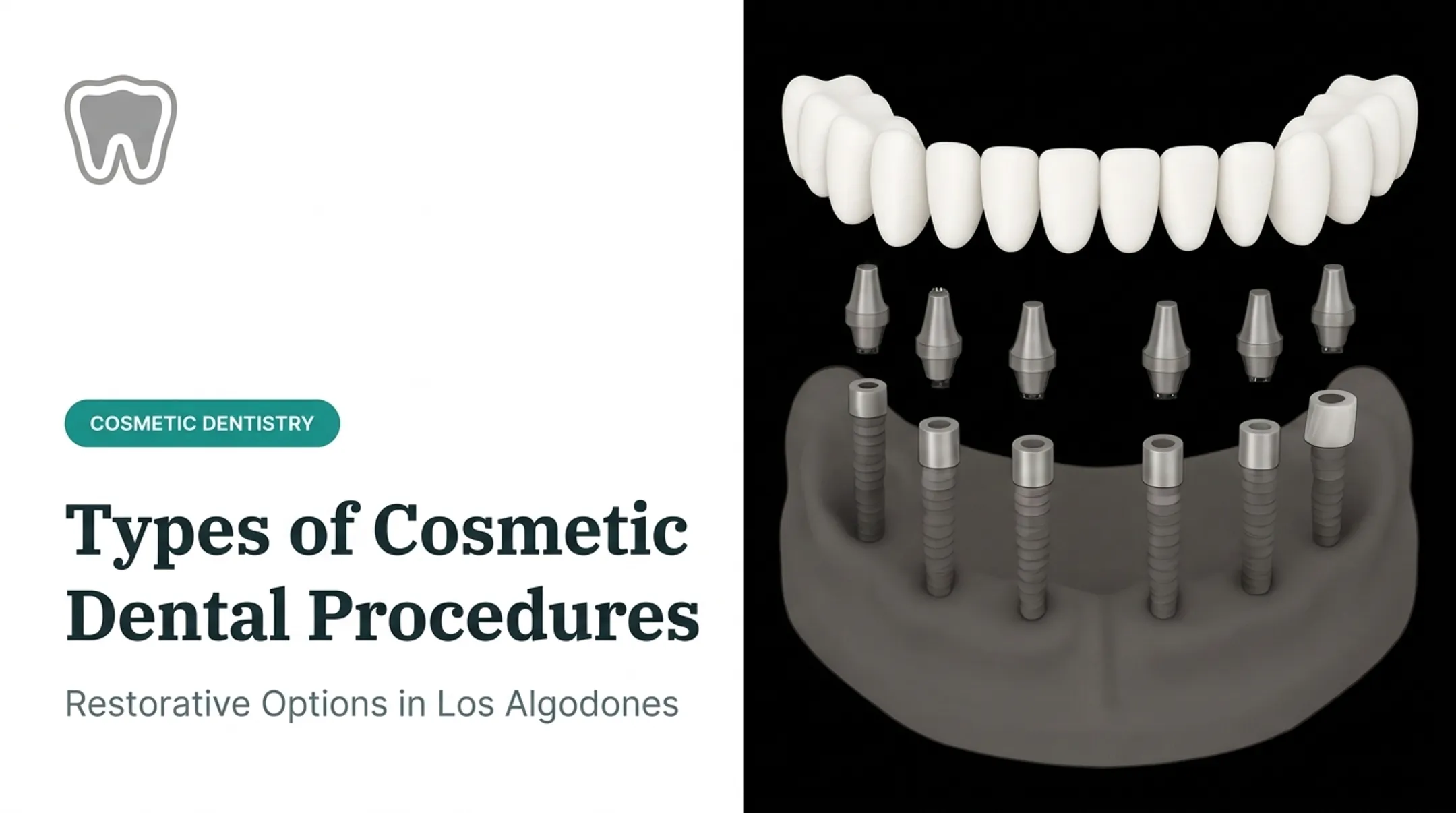 Types of Cosmetic Dental Procedures