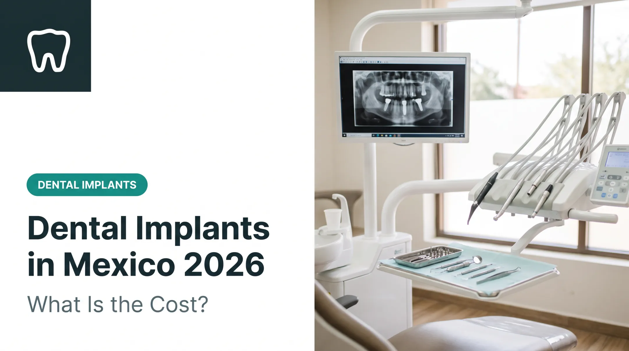 Dental Implants in Mexico 2026: What Is the Cost?