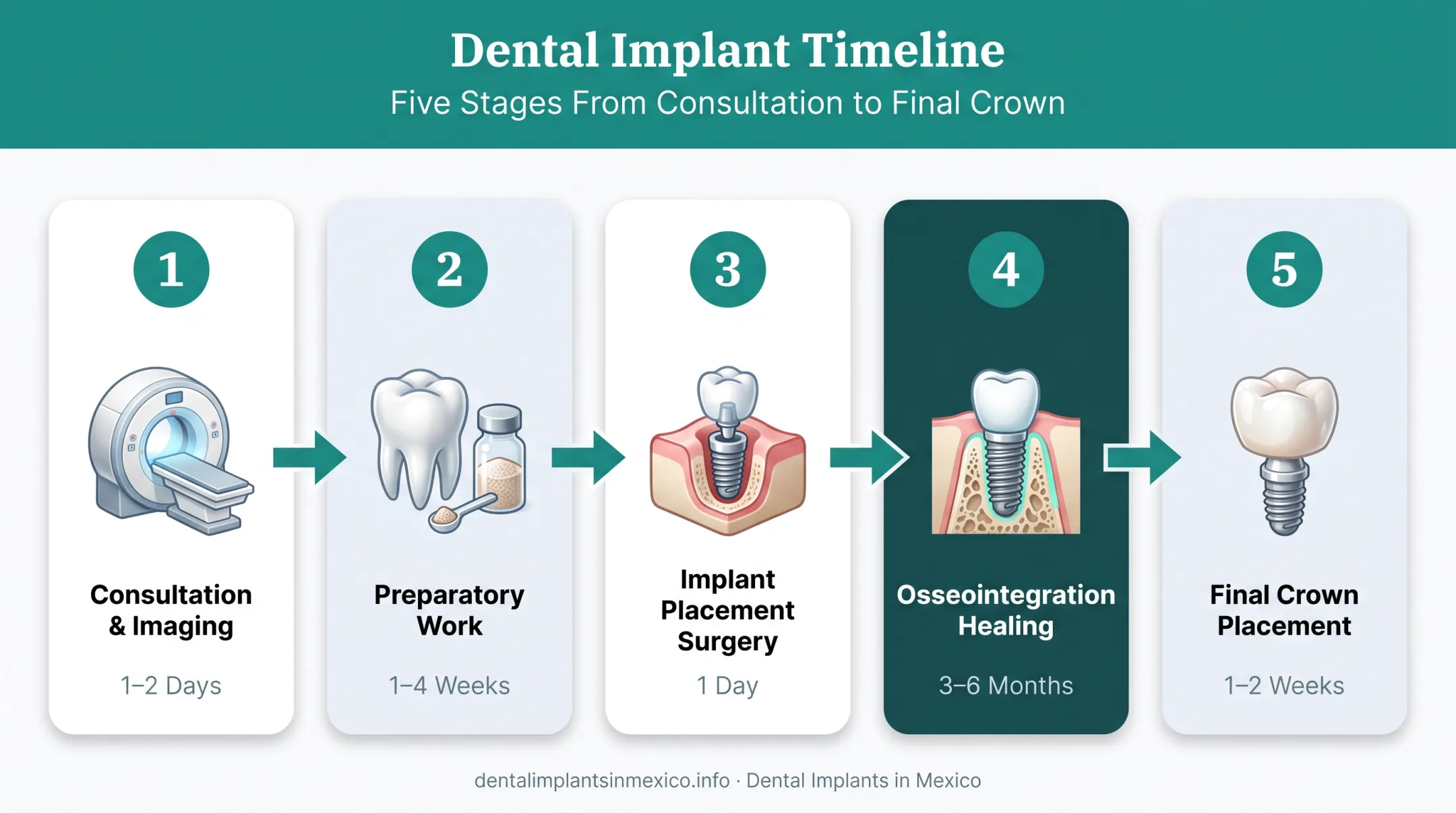 5-step dental implant procedure timeline from consultation to final crown