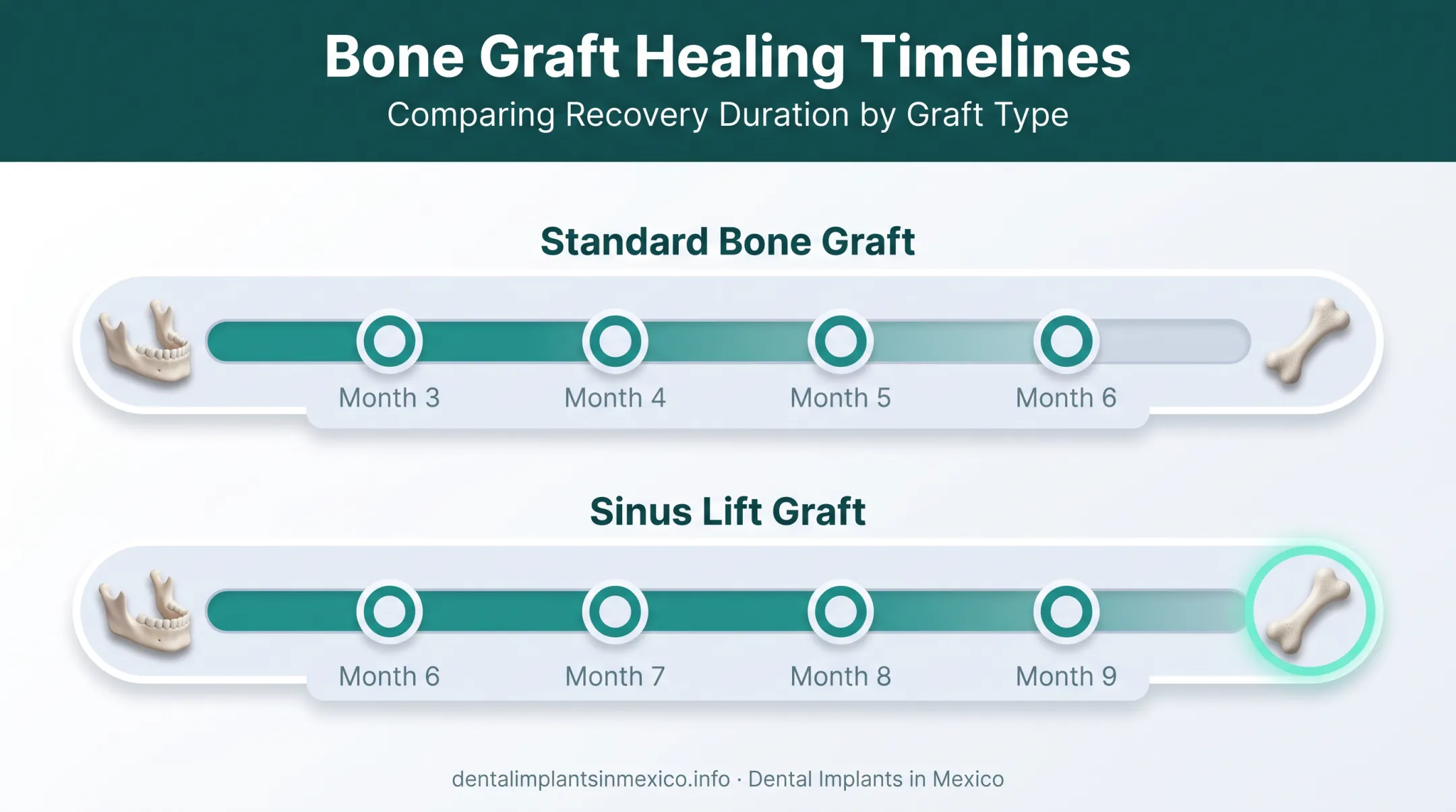 Bone grafting versus sinus lift healing timeline comparison chart