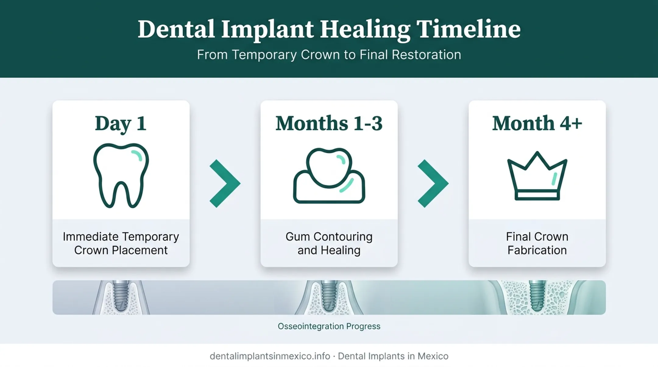 Timeline of temporary crown role during dental implant osseointegration healing