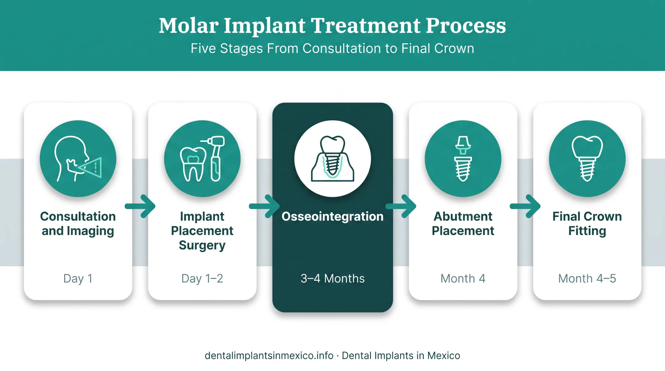 5-step dental implant process timeline from consultation to final crown