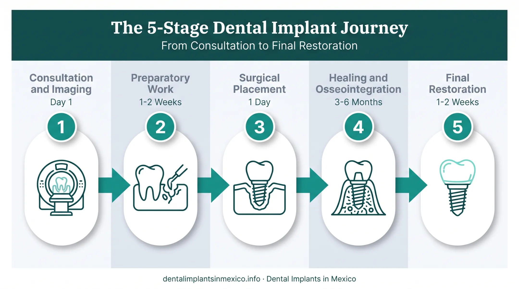 5-step titanium implant procedure timeline from consultation to crown